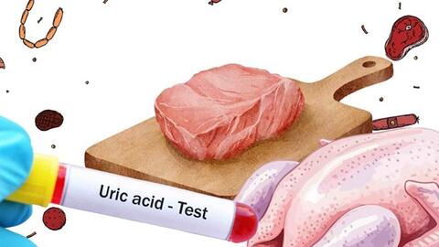 Thịt gà hay thịt bò làm tăng axit uric nhiều hơn