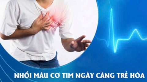 Bác sĩ cảnh báo về ca nhồi máu cơ tim ở bệnh nhân 22 tuổi