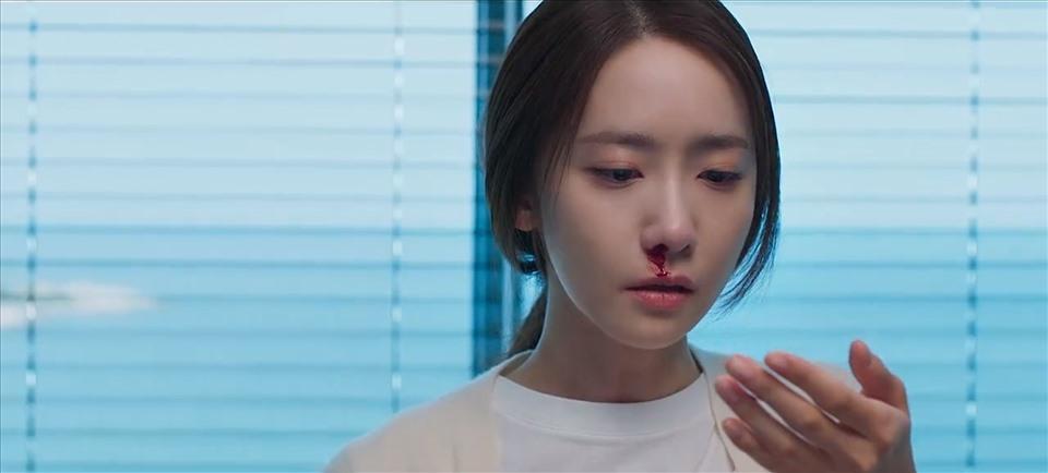 Mi Ho (YoonA) mắc ung thư, “Big Mouth” có kết thúc buồn?