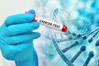 Việc xét nghiệm gen giúp y học có thêm bước tiến trong xác định yếu tố di truyền, nguy cơ mắc ung thư. (Ảnh: BYT)