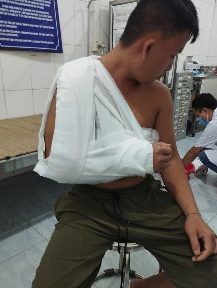 Anh Bùi Văn Thơ, xóm Trám, xã Toàn Thắng bị trật khớp vai khi kéo xác lợn chết trên suối vào bờ chôn lấp. Ảnh: NVCC