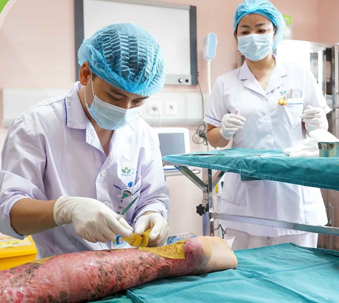 Bé trai bỏng nặng vì tự làm thí nghiệm với cồn