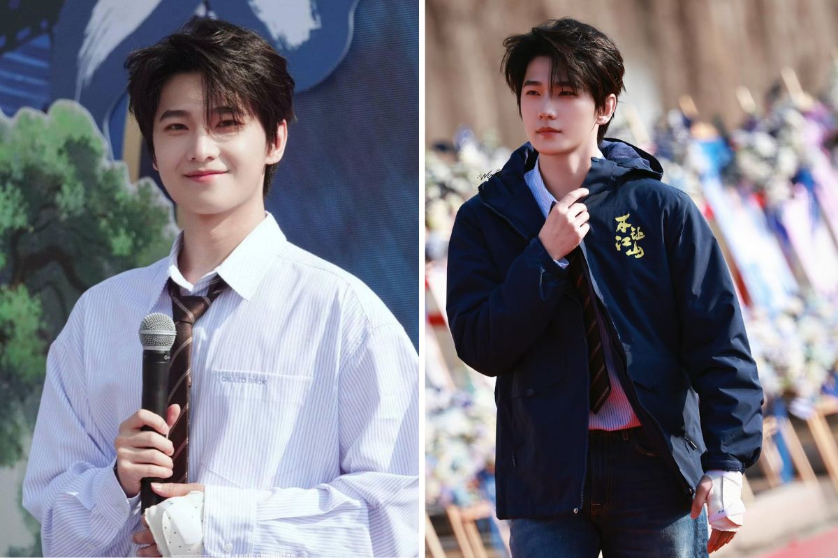 Dương Dương để lộ tay bị chấn thương trong ngày khai máy phim. Ảnh: Nhà sản xuất