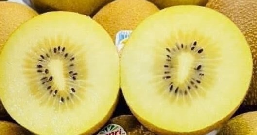 Lý do suy thận nên hạn chế ăn kiwi