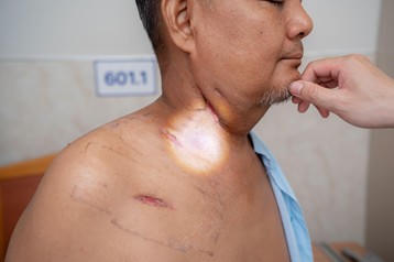 Vết thương người bệnh sau 3 tuần xuất viện, trước tái khám